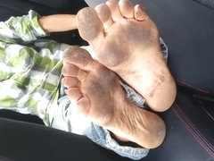 Leah's Homeless Feet *Warning Graphic Material*